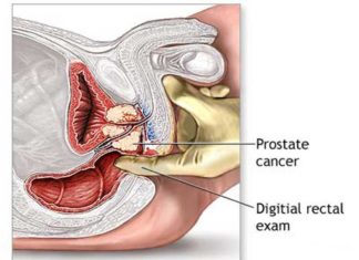 analiza prostata pret